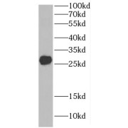 WB analysis of SH-SY5Y cells, using C9orf72 antibody (1/300 dilution).