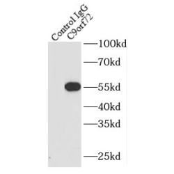 C9orf72 Antibody