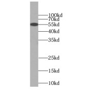 WB analysis of human brain tissue, using C9orf72 antibody (1/1000 dilution).