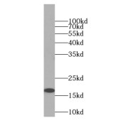 WB analysis of mouse testis tissue, using C9orf9 antibody (1/300 dilution).