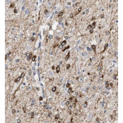 Carbonic Anhydrase 10 (CA10) Antibody