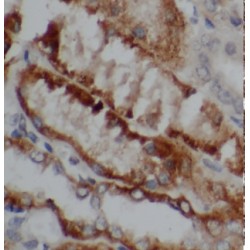 Carbonic Anhydrase 12 (CA12) Antibody