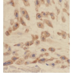 Carbonic Anhydrase 13 (CA13) Antibody