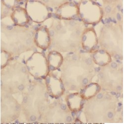 Carbonic Anhydrase 9 (CA9) Antibody