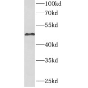 WB analysis of human stomach tissue, using CA9 antibody (1/1000 dilution).
