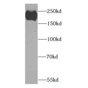 WB analysis of human brain tissue, using CACNA1S antibody (1/1000 dilution).