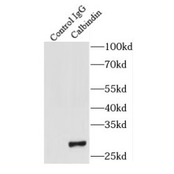 Calbindin (CALB1) Antibody