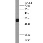 WB analysis of mouse brain tissue, using Calbindin-D28k antibody (1/1000 dilution).