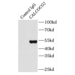 Calcium-Binding And Coiled-Coil Domain-Containing Protein 2 (CALCOCO2) Antibody