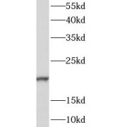 WB analysis of human heart tissue, using CaML6 antibody (1/500 dilution).