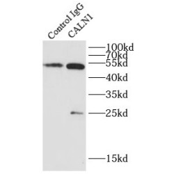 Calcium-Binding Protein 8 (CALN1) Antibody