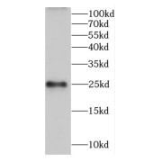 WB analysis of rat brain tissue, using CALN1 antibody (1/300 dilution).