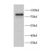 WB analysis of A431 cells, using CAPN1 antibody (1/1000 dilution).