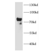 WB analysis of Y79 cells, using CAPN2 antibody (1/200 dilution).