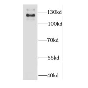 WB analysis of HeLa cells, using CAST antibody (1/1000 dilution).