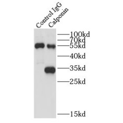 Calponin (CNN) Antibody