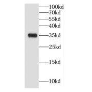 WB analysis of mouse heart tissue, using Calponin antibody (1/1000 dilution).