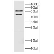 WB analysis of HEK-293 cells, using CALU antibody (1/800 dilution).