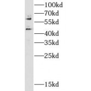 WB analysis of mouse brain tissue, using CAMK2 antibody (1/1000 dilution).