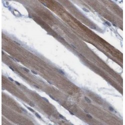 CaMKII beta Antibody