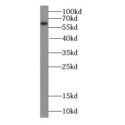 WB analysis of mouse brain tissue, using CAMK2B antibody (1/1000 dilution).