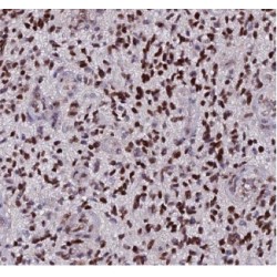 Calcium/Calmodulin Dependent Protein Kinase Kinase 1 (CAMKK1) Antibody