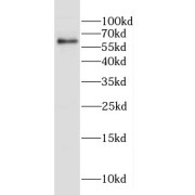WB analysis of Jurkat cells, using CAMKK1 antibody (1/1000 dilution).