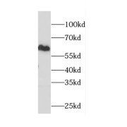 WB analysis of mouse brain tissue, using CAMKV antibody (1/1200 dilution).