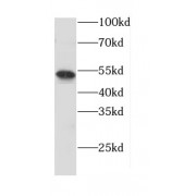 WB analysis of mouse brain tissue were subjected to SDS PAGE followed by western blot Cannabinoid receptor 1 antibody (1/1000 dilution).