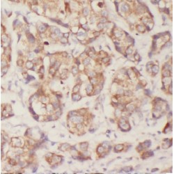 Caprin-1 (CAPRIN1) Antibody