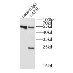 Calcyphosin-Like (CAPSL) Antibody