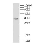 WB analysis of human brain tissue, using CAPZA1 antibody (1/400 dilution).
