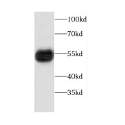 WB analysis of mouse pancreas tissue, using Carboxypeptidase A1 antibody (1/3000 dilution).