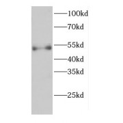 WB analysis of HL-60 cells, using CARD9 antibody (1/1500 dilution).