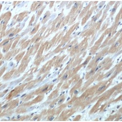 Troponin I, Cardiac Muscle (TNNI3) Antibody