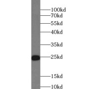 WB analysis of rat heart tissue, using TNNI3 antibody (1/1000 dilution).