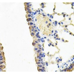Cysteinyl-tRNA Synthetase 1 (CARS1) Antibody