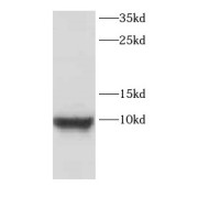 WB analysis of SH-SY5Y cells, using CARTPT antibody (1/800 dilution).