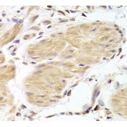 Caspase 2 (CASP2) Antibody