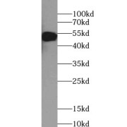WB analysis of HeLa cells, using CASP2 antibody (1/500 dilution).