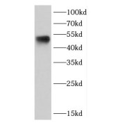 WB analysis of HeLa cells, using CASP2 antibody (1/1000 dilution).