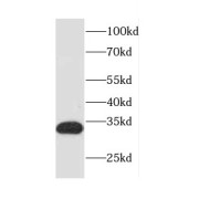 WB analysis of Jurkat cells, using CASP6 antibody (1/800 dilution).
