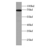 WB analysis of mouse liver tissue, using SLC7A1 antibody (1/800 dilution).