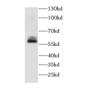 WB analysis of Sp2/0 cells, using Cathepsin A antibody (1/300 dilution).