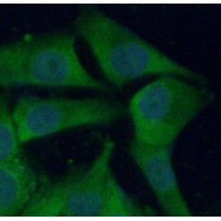Cathepsin B (CTSB) Antibody