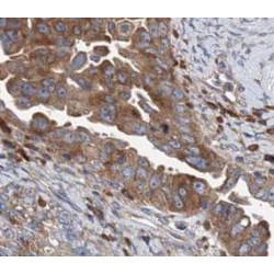 Cathepsin B (CTSB) Antibody