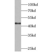 WB analysis of A375 cells, using CTSB antibody (1/800 dilution).