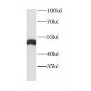 WB analysis of MCF7 cells, using CTSD antibody (1/1000 dilution).