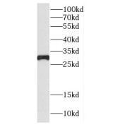 WB analysis of MCF-7 cells, using Cathepsin G antibody (1/600 dilution).