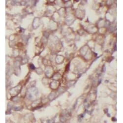 Caveolin-1 (CAV1) Antibody